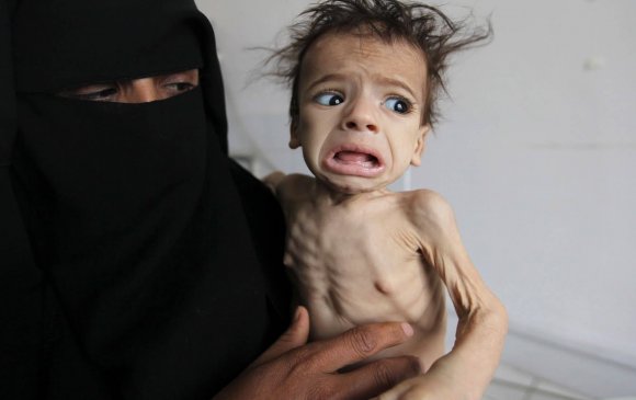 Йемений дайны улмаас өлсгөлөн газар авч байна гэв