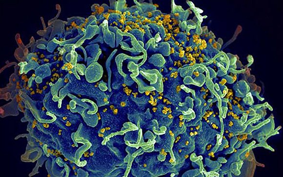 ХДХВ-гийн халдварын эсрэг эм ойрын 2-3 жилд бэлэн болно гэв