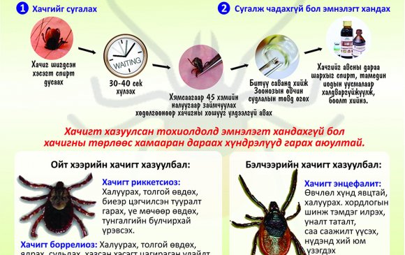 Хачигт халдварт өвчнөөс урьдчилан сэргийлье!