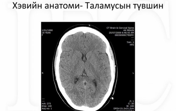 Толгойн компьютер томографи