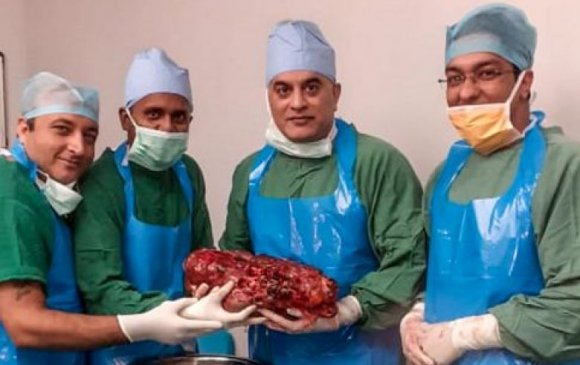 Энэтхэгийн эмч нар өвчтөний биеэс 7,4 кг жинтэй бөөрийг амжилттай гаргажээ