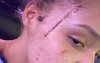 29130458-8420417-Pictured_Some_of_the_injuries_Yasmine_sustained_in_the_alleged_a-a-13_1592227331319