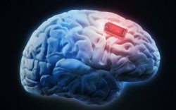 Мэргэжилтнүүд тархины чипний аюулгүй байдалд эргэлзэж байна