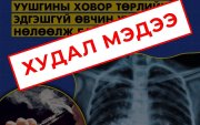 EVALI болон "Popcorn Lung" өвчлөлийн талаарх буруу мэдээлэлд анхаарал хандуулъя