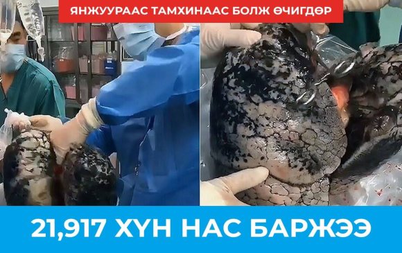Дэлхий дахинаа: Өчигдөр 21,917 хүн нас барлаа
