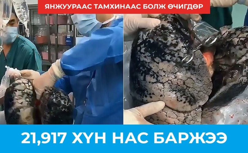 Дэлхий дахинаа: Өчигдөр 21,917 хүн нас барлаа