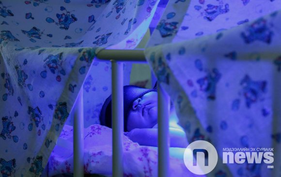 Улсын хэмжээнд шинэ нярайн 60-80 хувь нь шарлалттай төрж байна
