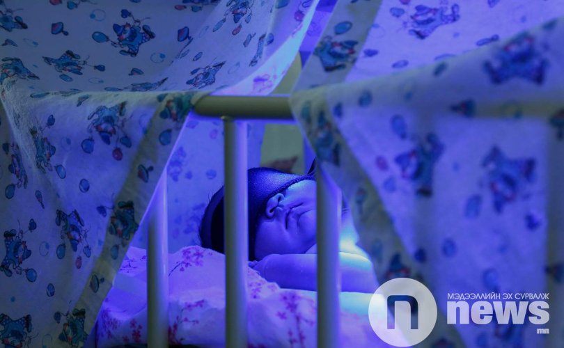 Улсын хэмжээнд шинэ нярайн 60-80 хувь нь шарлалттай төрж байна
