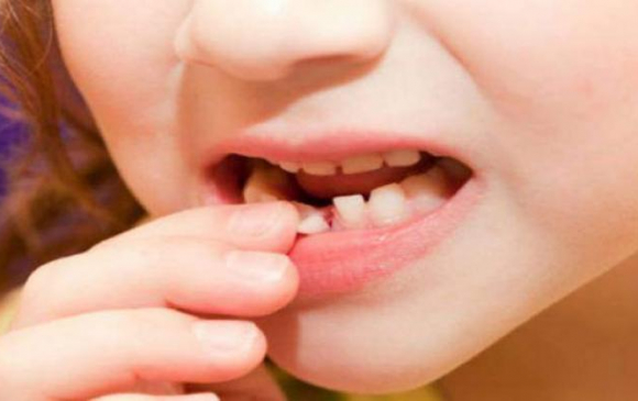 “Эрүүл шүд-Эрүүл хүүхэд” хөтөлбөр 2019 оноос хэрэгжинэ